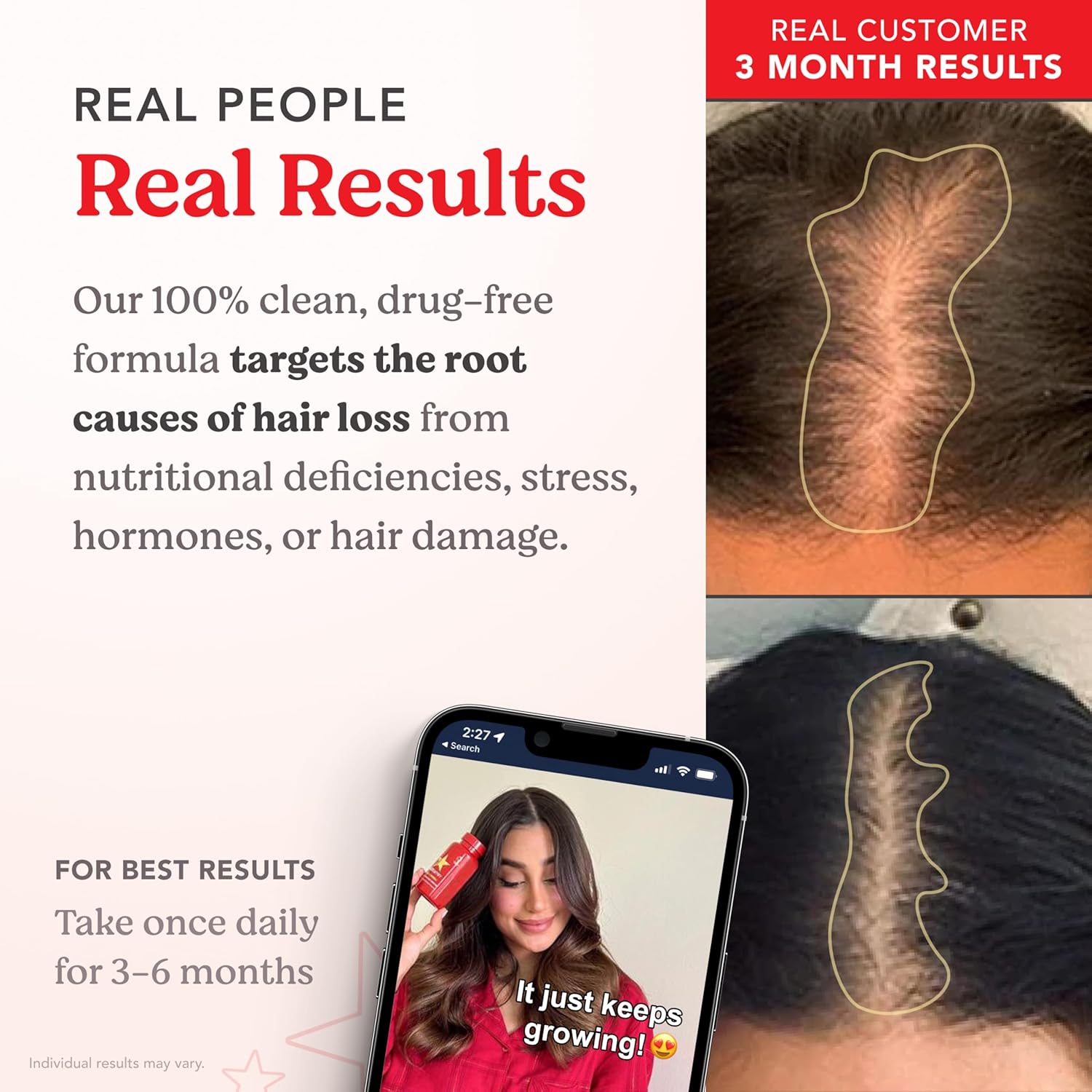 Hairtamin Advanced Hair Growth Supplement - Image 2